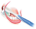 Pravilno pranje zuba četkanje zuba 1
